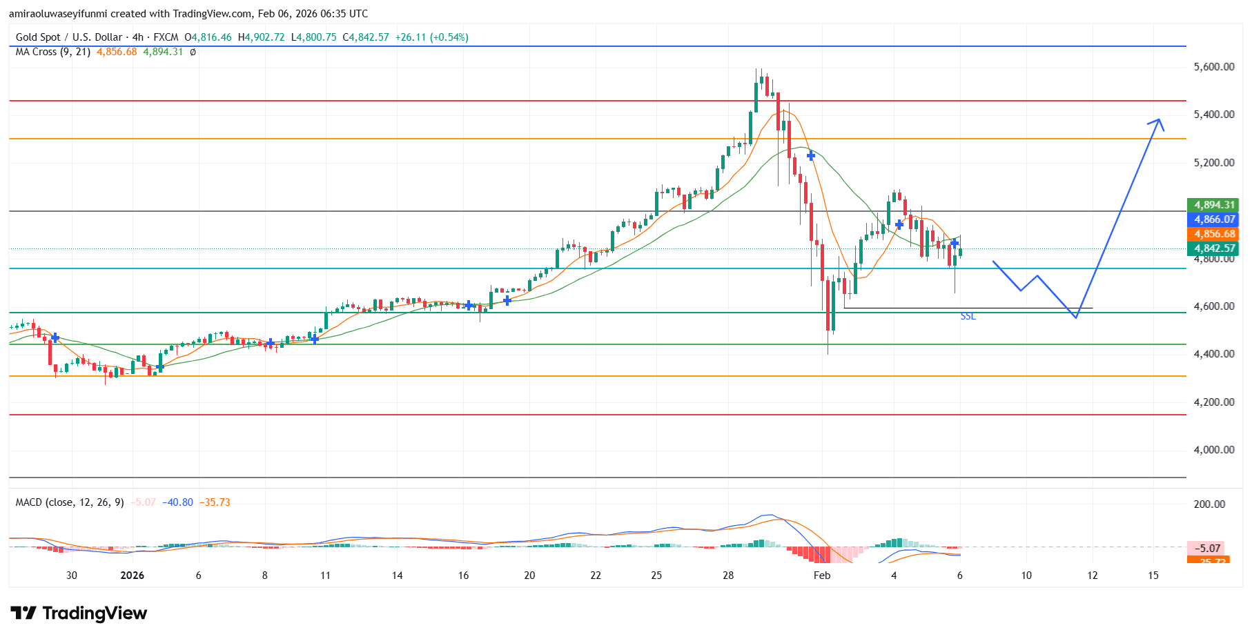 Gold (XAUUSD) Stays Upward As Bullish Trend Strength Persists